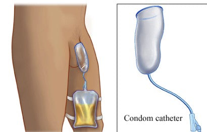 CONDOM CATHETER